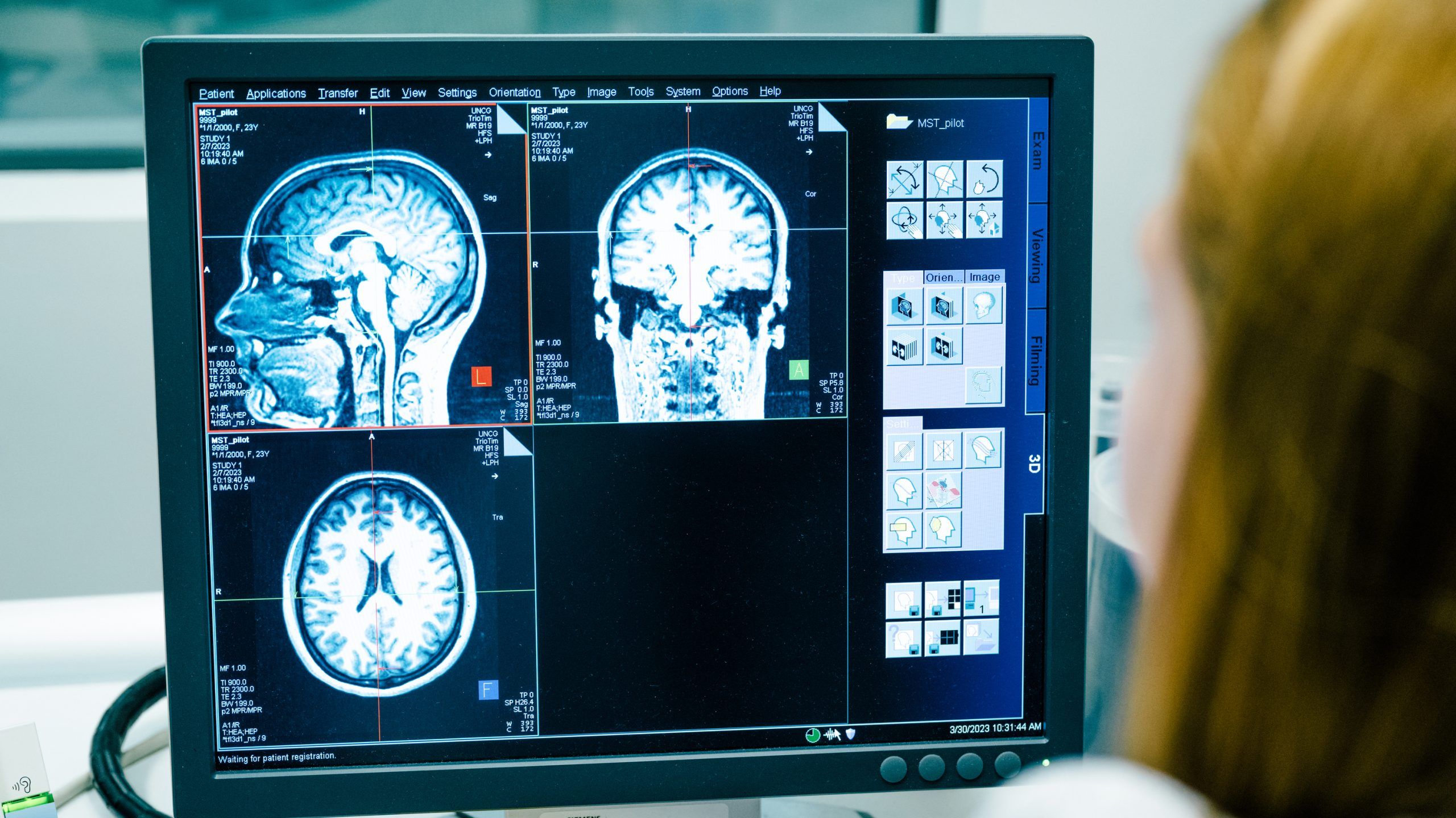 A person looking at the results of an MRI of the human brain