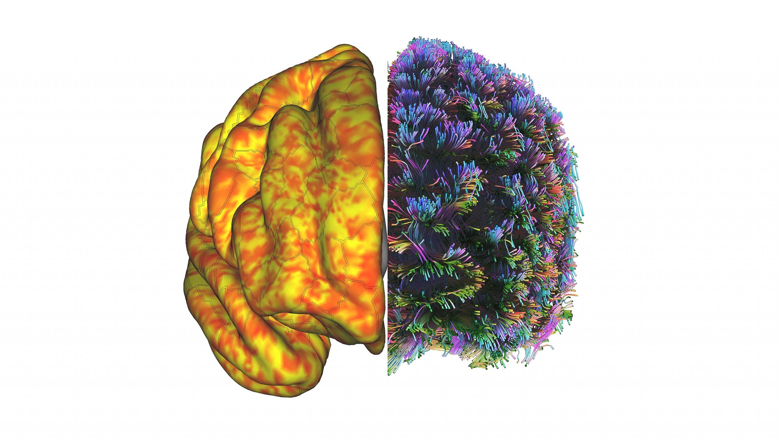 Front view of human brain with one side that is yellow and orange and the other multicolored