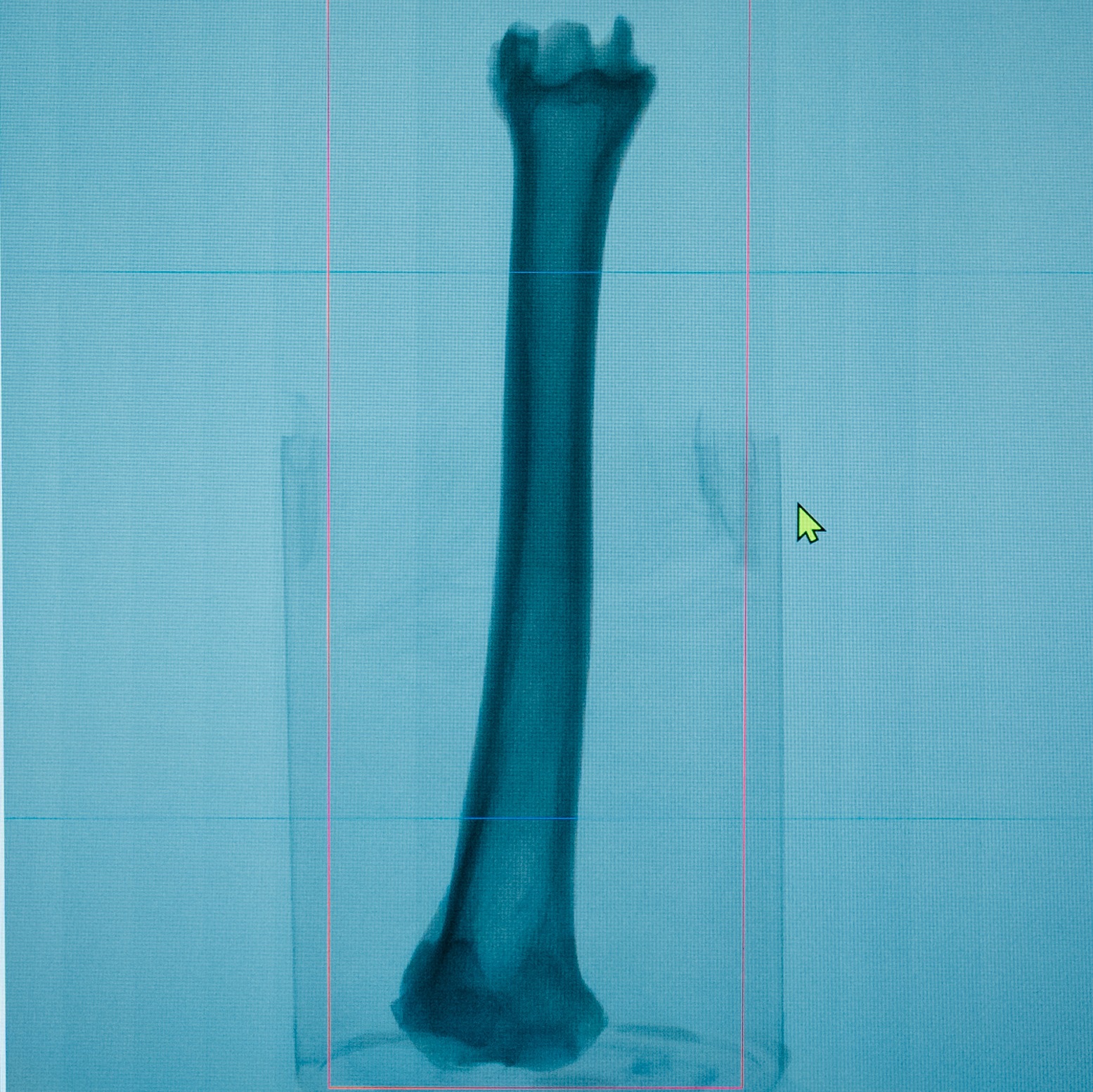 a scan of a bone